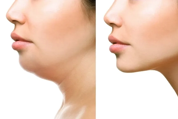 Oral and Maxillofacial rehabilitation