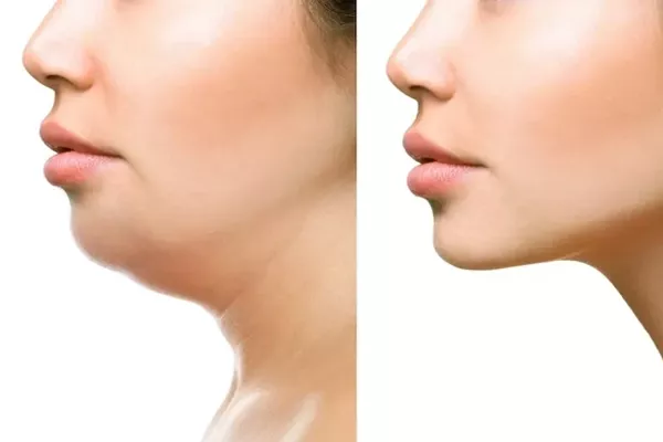 Oral and Maxillofacial rehabilitation